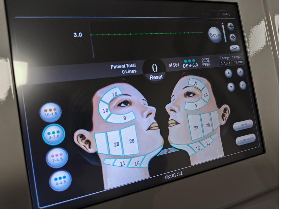 Ultralift HI-FU treatment mapping on the device screen